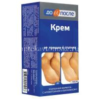 Крем ДО И ПОСЛЕ п/трещин в ступнях 150мл (Твинс Тэк/Россия)
